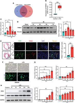 TRIM21 aggravates cardiac injury after myocardial infarction by promoting M1 macrophage polarization